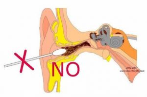 earwax buildup tip